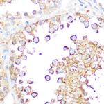 DIABLO Antibody in Immunohistochemistry (Paraffin) (IHC (P))