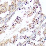DIABLO Polyclonal Antibody