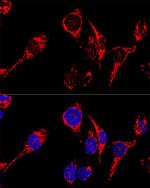 AIF Polyclonal Antibody