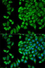 WNK1 Polyclonal Antibody