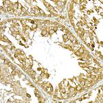 TBK1 Polyclonal Antibody