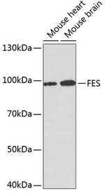 FES Polyclonal Antibody