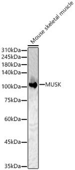 MUSK Polyclonal Antibody