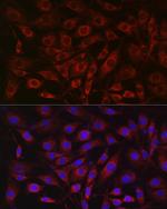 SDHA Polyclonal Antibody