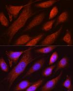 RHOT2 Polyclonal Antibody