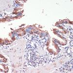 MSI1 Antibody in Immunohistochemistry (Paraffin) (IHC (P))