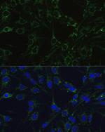 COX5B Antibody in Immunocytochemistry (ICC/IF)