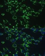 COX5B Polyclonal Antibody