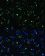 COX5B Antibody in Immunocytochemistry (ICC/IF)