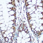 COX5B Antibody in Immunohistochemistry (Paraffin) (IHC (P))