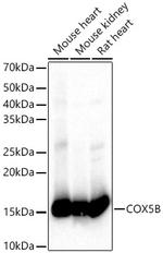 COX5B Antibody in Western Blot (WB)