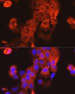 Cytokeratin 15 Antibody in Immunocytochemistry (ICC/IF)