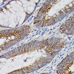 IL-18Ra Polyclonal Antibody