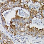 IL-18Ra Antibody in Immunohistochemistry (Paraffin) (IHC (P))
