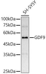 GDF9 Polyclonal Antibody