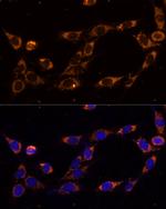 TRAP1 Polyclonal Antibody