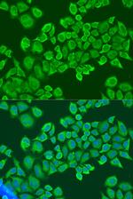 IGF2BP2 Polyclonal Antibody