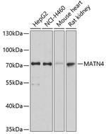 MATN4 Polyclonal Antibody