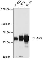 DNAJC7 Antibody in Western Blot (WB)