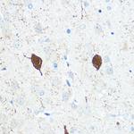 Parvalbumin Polyclonal Antibody