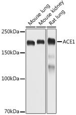 ACE Antibody in Western Blot (WB)