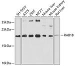 RAB18 Polyclonal Antibody