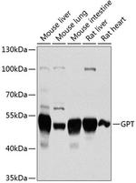 GPT Polyclonal Antibody