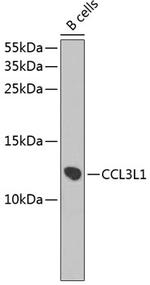 CCL3L1 Antibody in Western Blot (WB)