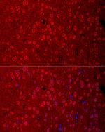 EAAC1 Polyclonal Antibody