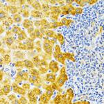 EDA Antibody in Immunohistochemistry (Paraffin) (IHC (P))