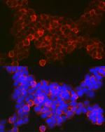 NFATC2 Polyclonal Antibody