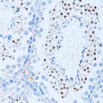 NFkB p100 Antibody in Immunohistochemistry (Paraffin) (IHC (P))