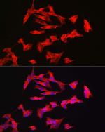 PACAP Receptor Polyclonal Antibody