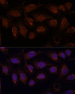 PP2A beta Polyclonal Antibody