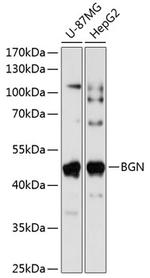 Biglycan Polyclonal Antibody