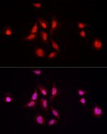 NFIA Antibody in Immunocytochemistry (ICC/IF)