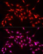 NFIA Antibody in Immunocytochemistry (ICC/IF)