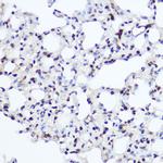 NFIA Antibody in Immunohistochemistry (Paraffin) (IHC (P))