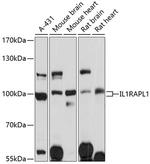 IL1RAPL1 Polyclonal Antibody
