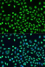 STAU2 Polyclonal Antibody