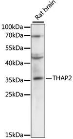 THAP2 Antibody in Western Blot (WB)