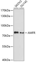 AMFR Polyclonal Antibody