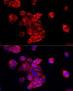 ECHS1 Antibody in Immunocytochemistry (ICC/IF)