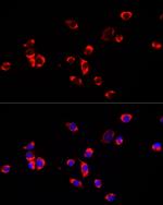 ECHS1 Polyclonal Antibody