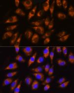 GRK5 Polyclonal Antibody