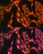 LASP1 Antibody in Immunocytochemistry (ICC/IF)