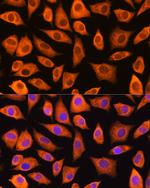 LASP1 Antibody in Immunocytochemistry (ICC/IF)
