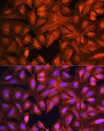 LASP1 Polyclonal Antibody