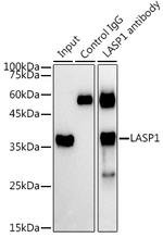LASP1 Antibody in Immunoprecipitation (IP)