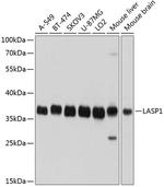 LASP1 Antibody in Western Blot (WB)